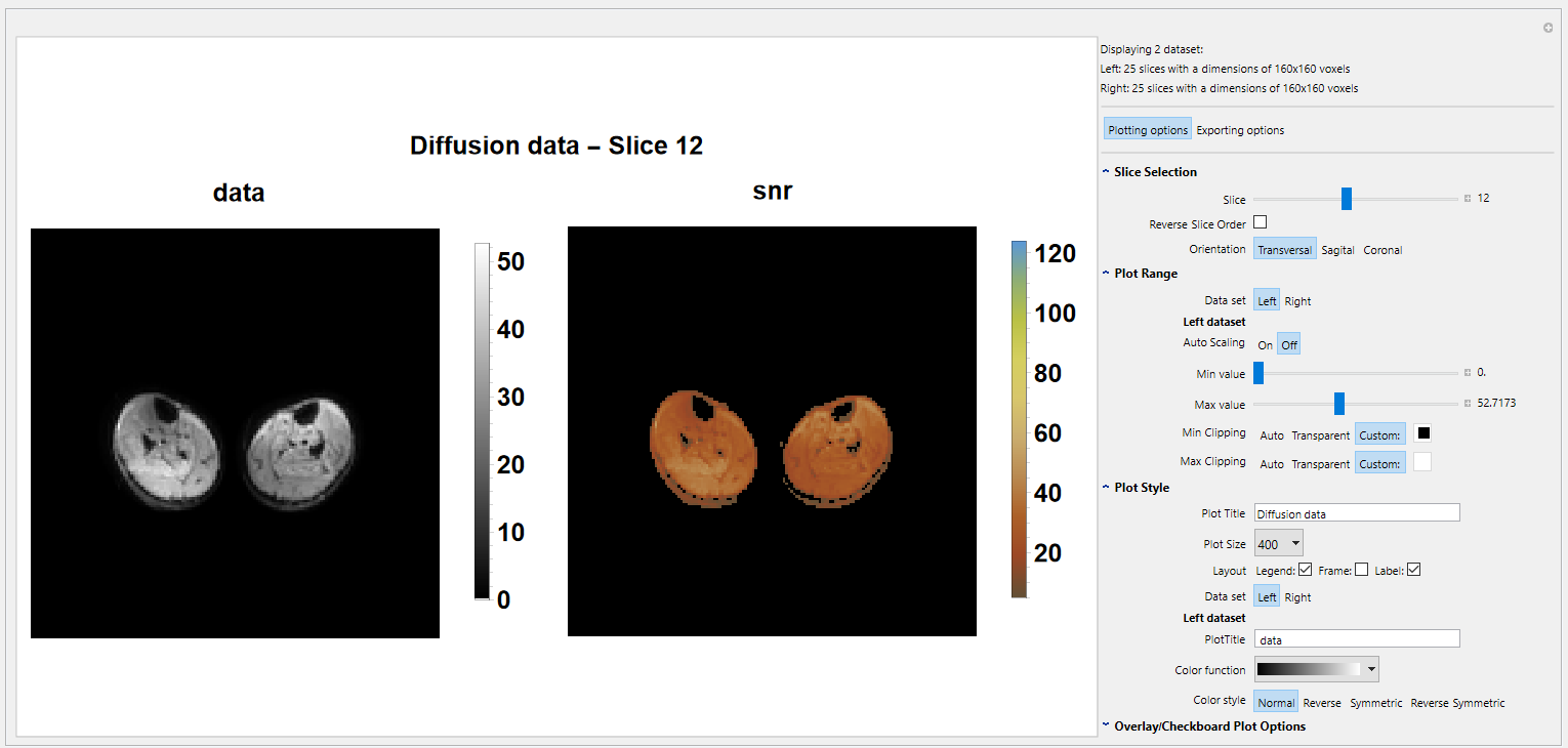 data vizualization